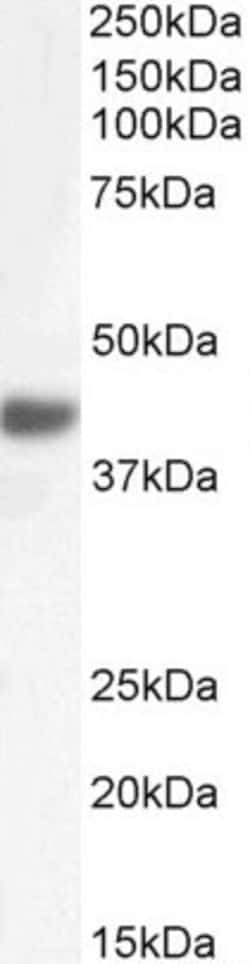 Invitrogen FBXO32 Polyclonal Antibody 100 &mu;g; Unconjugated:Antibodies,
