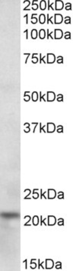 Invitrogen Ferritin Heavy Chain Polyclonal Antibody 100 &mu;g; Unconjugated:Antibodies,