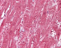 Invitrogen CSRP3 Polyclonal Antibody 100 &mu;g; Unconjugated:Antibodies,