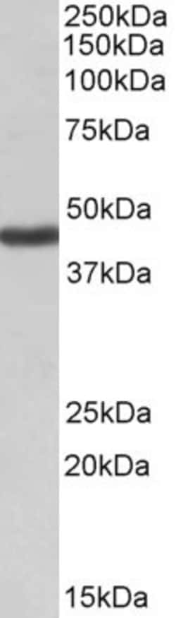 Invitrogen Kir1.1 (KCNJ1) Polyclonal Antibody 100 &mu;g; Unconjugated:Antibodies,