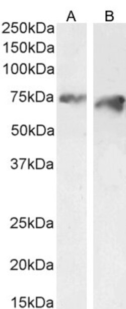 Invitrogen PCSK9 Polyclonal Antibody 100 &mu;g; Unconjugated:Antibodies,