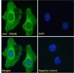 Invitrogen ITM2B Polyclonal Antibody 100 &mu;g; Unconjugated:Antibodies,