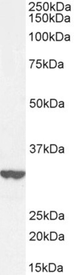 Invitrogen ITM2B Polyclonal Antibody 100 &mu;g; Unconjugated:Antibodies,