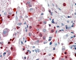 Invitrogen S100A9 Polyclonal Antibody 100 &mu;g; Unconjugated:Antibodies