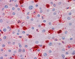 Invitrogen S100A9 Polyclonal Antibody 100 &mu;g; Unconjugated:Antibodies