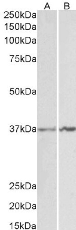 Invitrogen Annexin A1 Polyclonal Antibody 100 &mu;g; Unconjugated:Antibodies,