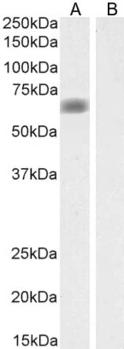 Invitrogen SLC47A1 Polyclonal Antibody 100 &mu;g; Unconjugated:Antibodies,