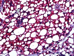 Invitrogen TSPO Polyclonal Antibody 100 &mu;g; Unconjugated:Antibodies,