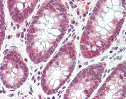 Invitrogen SH2D3A Polyclonal Antibody 100 &mu;g; Unconjugated:Antibodies,