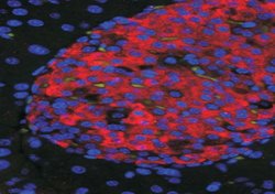 Invitrogen UNC5C Polyclonal Antibody 100 &mu;g; Unconjugated:Antibodies,