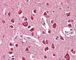 Invitrogen UNC5C Polyclonal Antibody 100 &mu;g; Unconjugated:Antibodies,