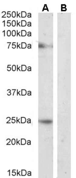 Invitrogen DLL1 Polyclonal Antibody 100 &mu;g; Unconjugated:Antibodies,