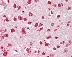Invitrogen LIMP2 Polyclonal Antibody 100 &mu;g; Unconjugated:Antibodies,