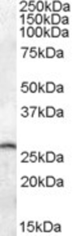 Invitrogen PSPH Polyclonal Antibody 100 &mu;g; Unconjugated:Antibodies,