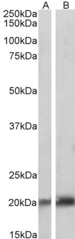 Invitrogen Caveolin 3 Polyclonal Antibody 100 &mu;g; Unconjugated:Antibodies,