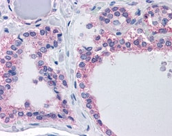Invitrogen CENTG1 Polyclonal Antibody 100 &mu;g; Unconjugated:Antibodies,
