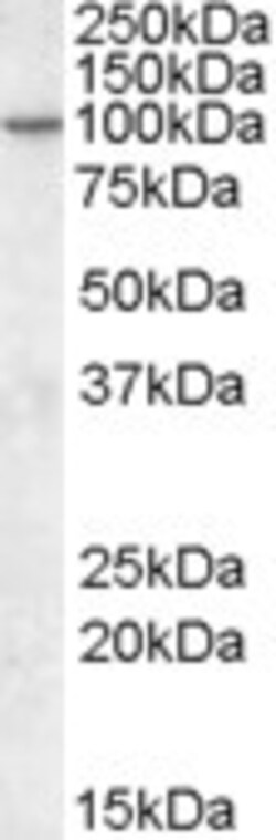 Invitrogen CENTG1 Polyclonal Antibody 100 &mu;g; Unconjugated:Antibodies,