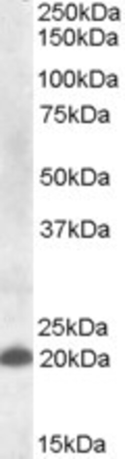 Invitrogen CLEC4C Polyclonal Antibody 100 &mu;g; Unconjugated:Antibodies,