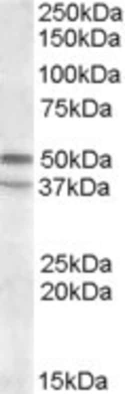 Invitrogen HTR7 Polyclonal Antibody 100 &mu;g; Unconjugated:Antibodies,