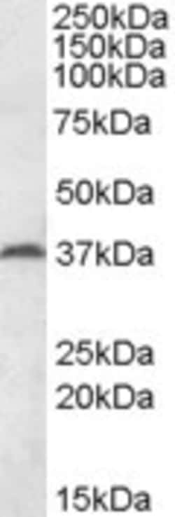 Invitrogen MEST Polyclonal Antibody 100 &mu;g | Buy Online | Invitrogen&trade; | Fisher Scientific