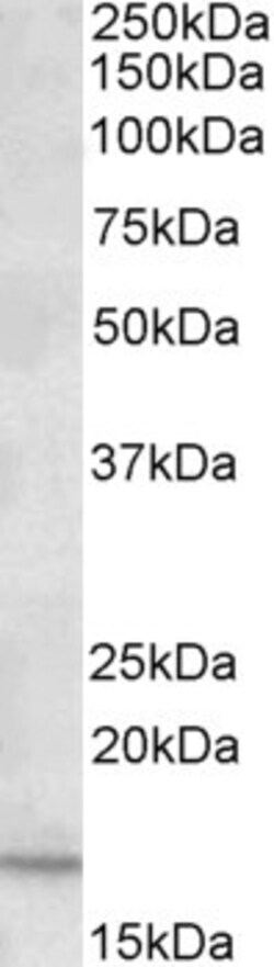 CXCL2 Polyclonal Antibody, Invitrogen 100 &mu;g; Unconjugated:Antibodies,