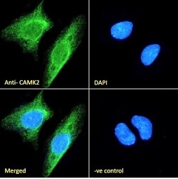 Invitrogen CaMKII alpha Polyclonal Antibody 100 &mu;g; Unconjugated:Antibodies,