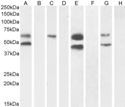 Invitrogen CaMKII alpha Polyclonal Antibody 100 &mu;g; Unconjugated:Antibodies,