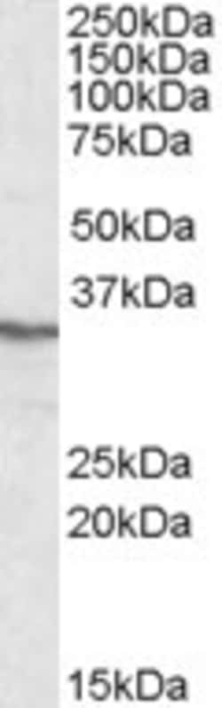Invitrogen PPP4C Polyclonal Antibody 100 &mu;g; Unconjugated:Antibodies,