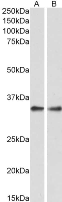 Invitrogen PPP4C Polyclonal Antibody 100 &mu;g; Unconjugated:Antibodies,
