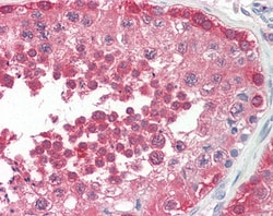 Invitrogen PPP2R4 Polyclonal Antibody 100 &mu;g; Unconjugated:Anticuerpos