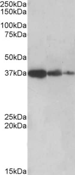 Invitrogen PPP2R4 Polyclonal Antibody 100 &mu;g; Unconjugated:Anticuerpos