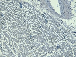 Invitrogen Nkx2.5 Polyclonal Antibody 100 &mu;g; Unconjugated:Antibodies,