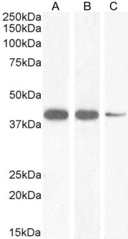 Invitrogen Nkx2.5 Polyclonal Antibody 100 &mu;g; Unconjugated:Antibodies,