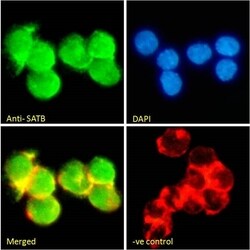 Invitrogen SATB1 Polyclonal Antibody 100 &mu;g; Unconjugated:Antibodies,
