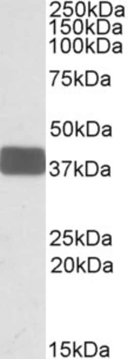 Invitrogen WNT9B Polyclonal Antibody 100 &mu;g; Unconjugated:Antibodies,