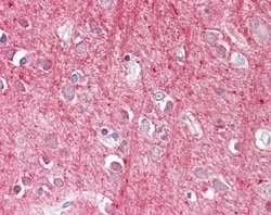 Invitrogen CD90 Polyclonal Antibody 100 &mu;g; Unconjugated:Antibodies,