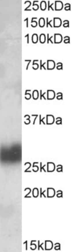 Invitrogen CD90 Polyclonal Antibody 100 &mu;g; Unconjugated:Antibodies,