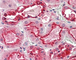 Invitrogen GGCX Polyclonal Antibody 100 &mu;g; Unconjugated:Anticuerpos