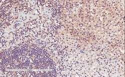 Invitrogen CD11a Polyclonal Antibody 100 &mu;g; Unconjugated:Antibodies,