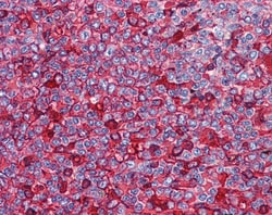 Invitrogen NFATC2 Polyclonal Antibody 100 μg; Unconjugated:Antibodies,