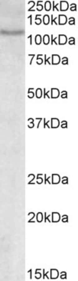 Invitrogen NFATC2 Polyclonal Antibody 100 μg; Unconjugated:Antibodies,