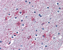 Invitrogen P2X7 Polyclonal Antibody 100 &mu;g | Buy Online | Invitrogen&trade; | Fisher Scientific