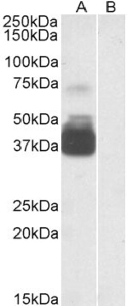 Invitrogen P2X7 Polyclonal Antibody 100 &mu;g | Buy Online | Invitrogen&trade; | Fisher Scientific