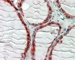 Invitrogen CLIP1 Polyclonal Antibody 100 &mu;g; Unconjugated:Antibodies,