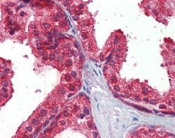 Invitrogen CLIP1 Polyclonal Antibody 100 &mu;g; Unconjugated:Antibodies,