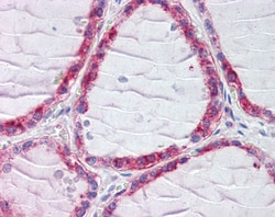 Invitrogen CLIP1 Polyclonal Antibody 100 &mu;g; Unconjugated:Antibodies,