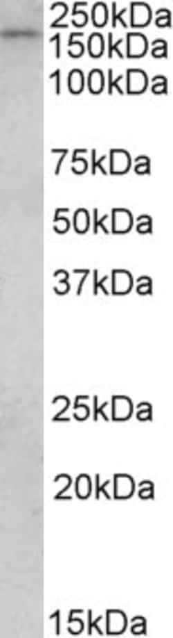 Invitrogen CLIP1 Polyclonal Antibody 100 &mu;g; Unconjugated:Antibodies,