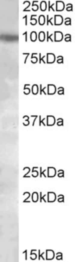 Invitrogen PKD2 Polyclonal Antibody 100 &mu;g; Unconjugated:Antibodies,