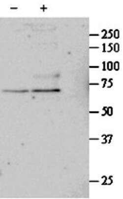 Invitrogen SRF Polyclonal Antibody 100 &mu;g; Unconjugated:Antibodies,