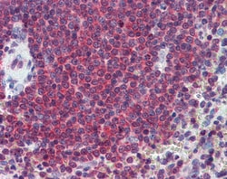 Invitrogen Carbonic Anhydrase I Polyclonal Antibody 100 μg; Unconjugated:Antibodies,